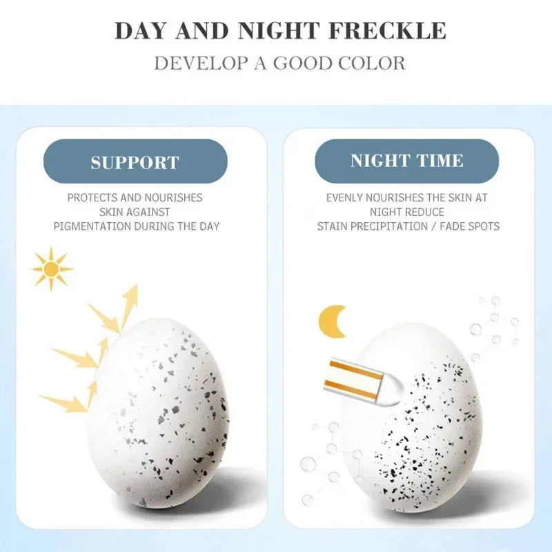 Melasma Brightening Face Cream Niacinamide Serum Brighten Cream Fade Fine Lines Lighten Dark Dot Reduce Melanin Face Skincare
