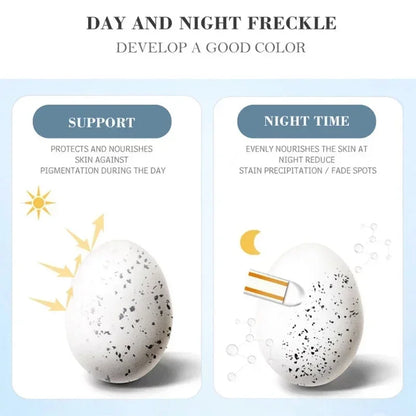 Melasma Brightening Face Cream Niacinamide Serum Brighten Cream Fade Fine Lines Lighten Dark Dot Reduce Melanin Face Skincare